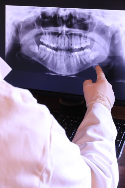 Best Emergency Dental Care for Broken or Chipped Teeth in Panguitch, UT